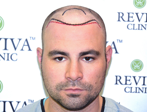 Slider image (4) Reviva Clinic